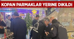 Parmakları Kopan Çocuk Ameliyat Edildi. Parmaklar Yerine Dikildi