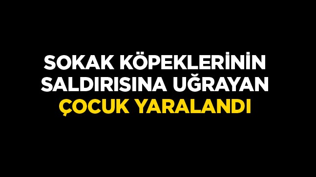 Çocuklar Sokak Hayvanlarının Tehlikesi Altında. Konya’da Köpeklerin Saldırdığı Çocuk Yaralandı