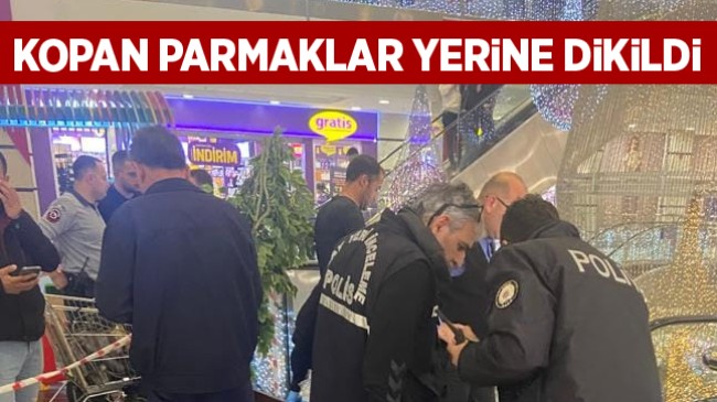 Parmakları Kopan Çocuk Ameliyat Edildi. Parmaklar Yerine Dikildi